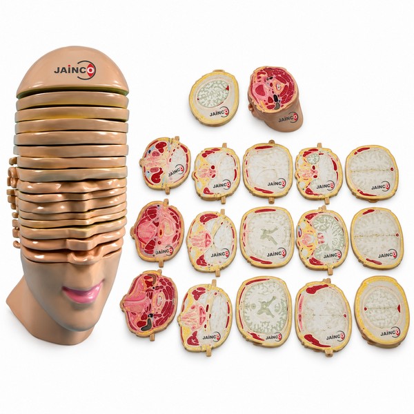 Model of the Head and Neck Horizontal Shears